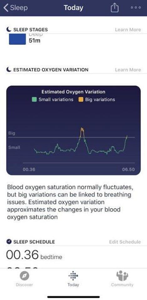 oxygen sensor fitbit versa